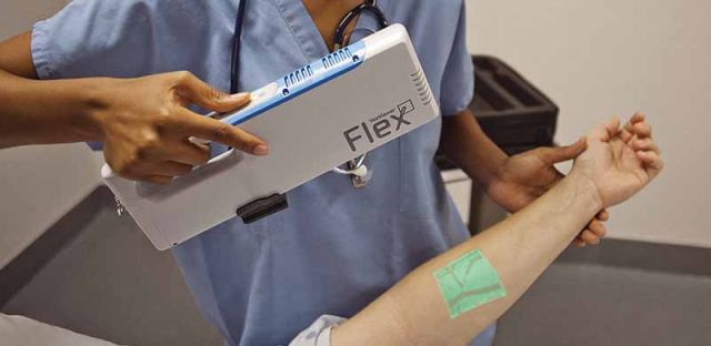 实习护士扎针不用慌！Vein Viewer投影灯帮你找出血管